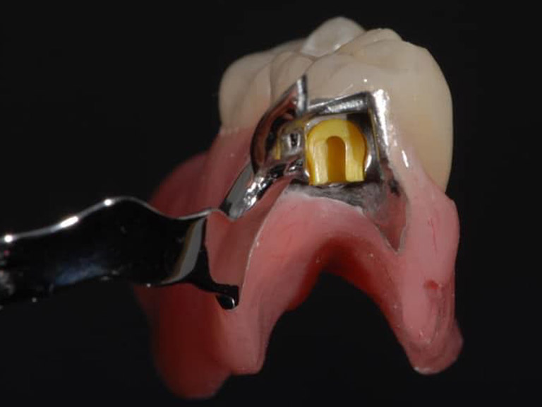 Bespoke Dentures Horwich Bolton Manchester