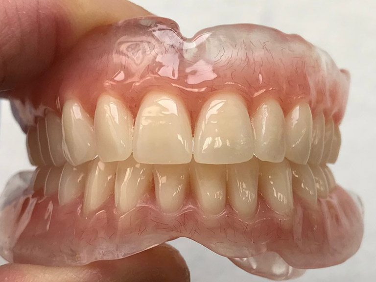Complete Dentures Horwich Denture Clinic Bolton Lancashire Northwest