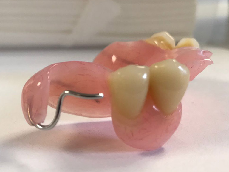 Partial Dentures Horwich Denture Clinic Bolton Lancashire Northwest