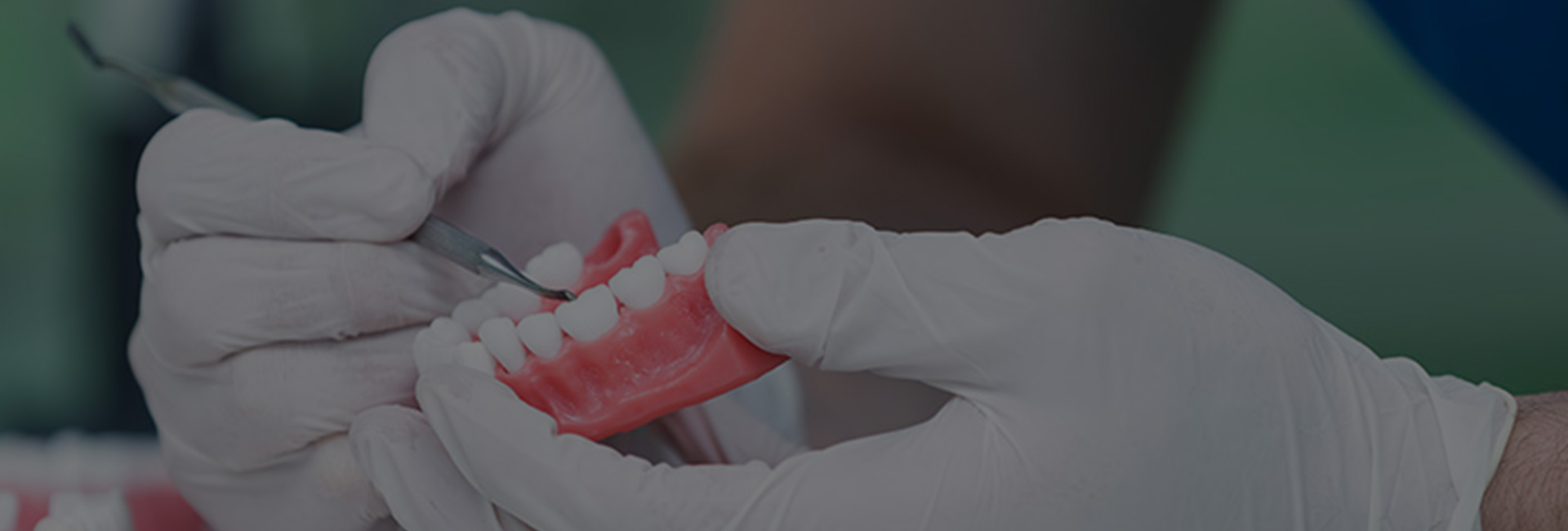 Repairs and Relines Horwich Denture Clinic Bolton Manchester Lancashire Northwest